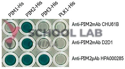 EDVOTEK Simulation of HIV Detection Kit